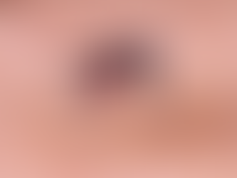 RS tem mais de 40 mil casos de dengue e 51 mortes; veja principais sintomas e como buscar ajuda