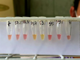 Pesquisadora da UFSM cria teste rápido para diagnóstico de tuberculose