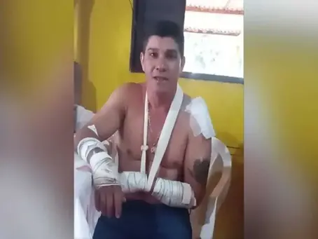 Onça pula em moto e ataca condutor no Mato Grosso do Sul