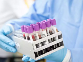 Hepatite D passa a ser considerada cancerígena pela Organização Mundial da Saúde