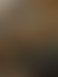 Granizo causou mais de R$ 20 milhões em prejuízos a produtores rurais de Erechim