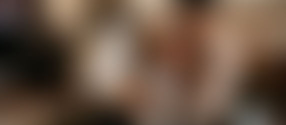 P: ¿Por qué mi hijo tiene fiebre recurrente de 38-39°C durante tres días sin otros síntomas excepto una ampolla en el labio?