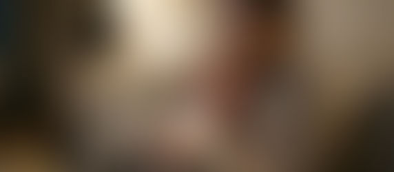 Q: 어제 저녁 예방접종 후 다음 날 38도의 열이 납니다. 접종열로 보고 지켜봐도 될까요, 아니면 병원에 가야 할까요?