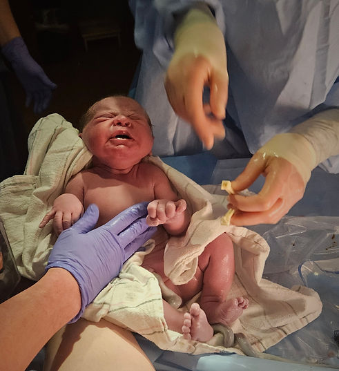 Baby being cleaned off by nurses after delivery