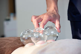 カッピング写真