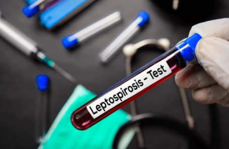 Health ministry warns against contaminated water as suspected cases of leptospirosis on the rise