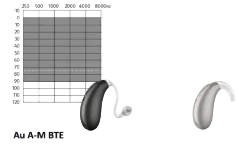 sonova am bte.png