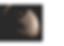 pregnancy.png