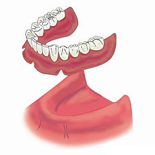 platon_implant_05+.jpg