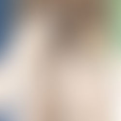 Tâches marrons aux yeux : Comment les gérer ?