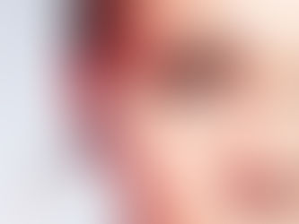 Botoks Kimler İçin Uygundur? Avantajları ve Yan Etkileri