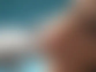 Mineral Dolgu (Kalsiyum Hidroksiapatit) ile Sıvı Yüz Germe: Genç ve Doğal Görünüm İçin Ameliyatsız Çözüm