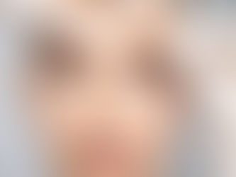 Botoks Sonrası Nelere Dikkat Edilmeli?
