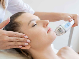 Altın İğne Korkularınız Son Bulsun: Virtue RF Farkı