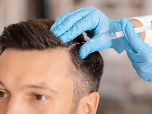 Saç Dökülmesinde Eksozom Tedavisi: Neden Denemelisiniz?