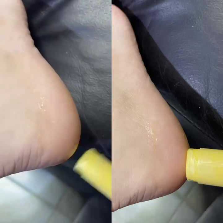 Thumbnail: 迷你潤足膏