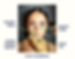 Wrinkle Reducing Injections