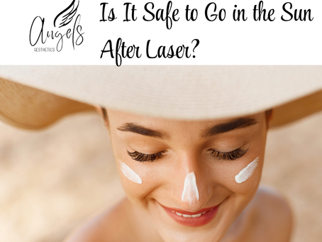 Is It Safe to Go in the Sun After Laser?