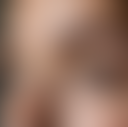 Will I Need Touch-ups After Microblading Treatment?