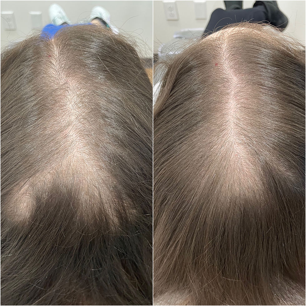 new growth with Alma TED