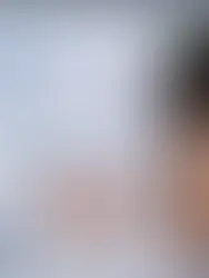 Professional HIFU Machine