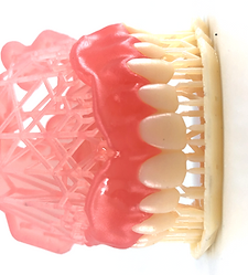 Printed Denture 4.png