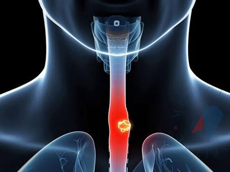 İnme ve Yutma Bozuklukları: Nedenleri, Belirtileri ve Tedavi Yaklaşımları