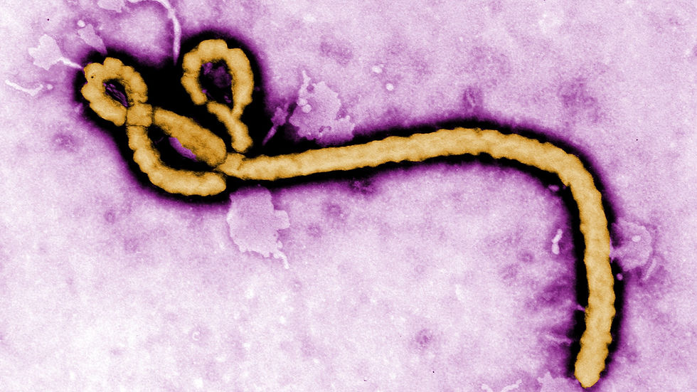 Ebola virus. FOTO: CDC