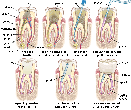 2 rcT 1.gif