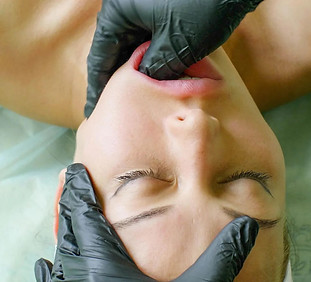 Buccal.jpg