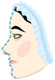 rhinoplasty-01_edited.png