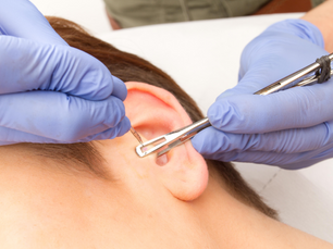 Jakie mogą być skutki nieumiejętnie wykonanego piercingu?