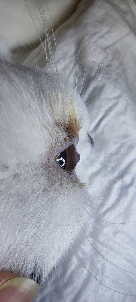 Co oznacza nagły przypadek okulistyczny?