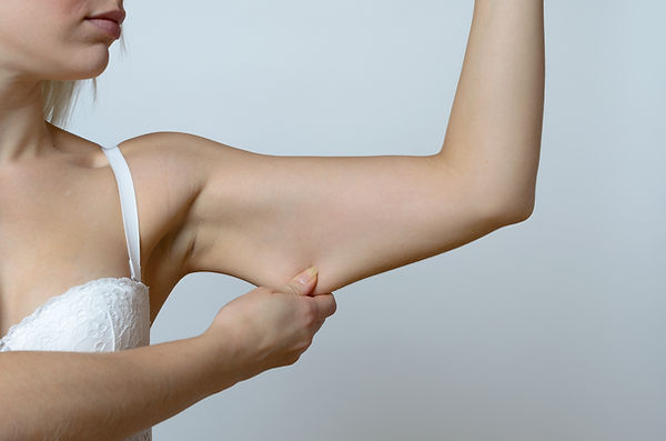 Fat Lipolysis, Deoxycholic acid, Belkyra, Kybella, fat reduction Burlington Ontario