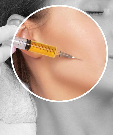 PRP and PRF treatments for face, hair regeneration, regenerative medicine treatments Burlington Ontario