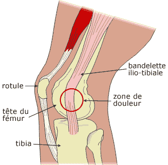 bandelette ilio-tibiale