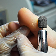 Bur_129714_large.jpg