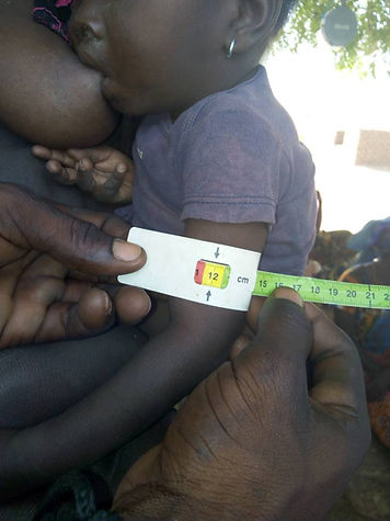 Child at Risk of Malnutrition