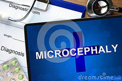Microcephaly