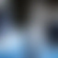 Het Belang van Kronen: De Kracht van Tandheelkundige Versterking