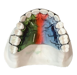 colorful retainer