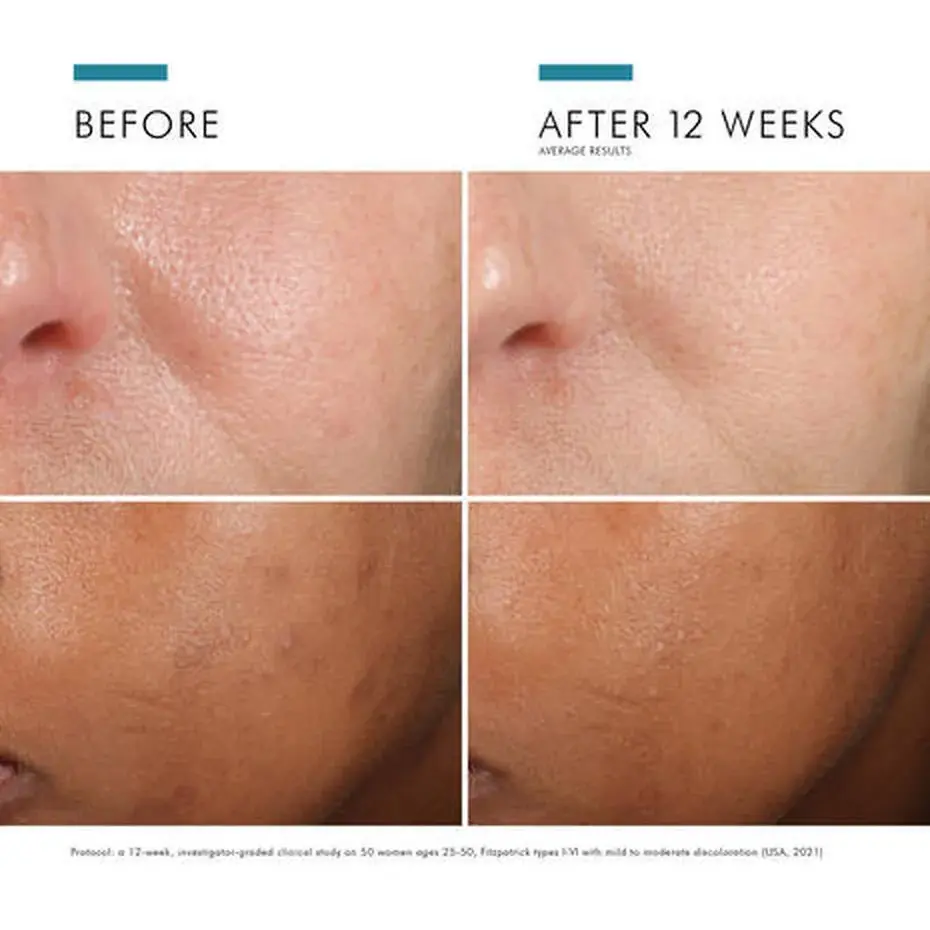 Thumbnail: Phloretin CF® with Ferulic Acid