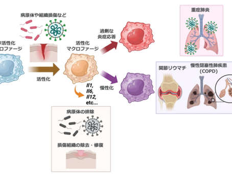 健康を科学で紐解く シリーズ179 「免疫細胞の炎症制御「硫黄代謝」がカギ」