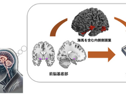 「パーキンソン病の認知機能障害の病態解明の鍵」-No.427
