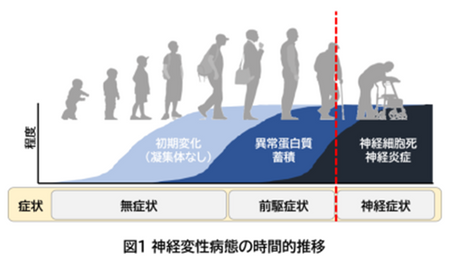 健康を科学で紐解く シリーズ16 「健診と連携してパーキンソン病予備群を診断」