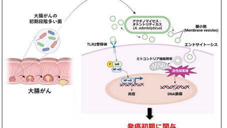 「腸内細菌の飛び道具が大腸がんの原因に」-No.297