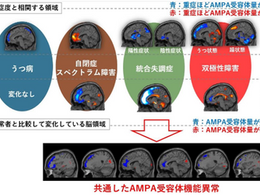 「“脳を見える化” 複数の精神疾患で共通する異常」-No.441