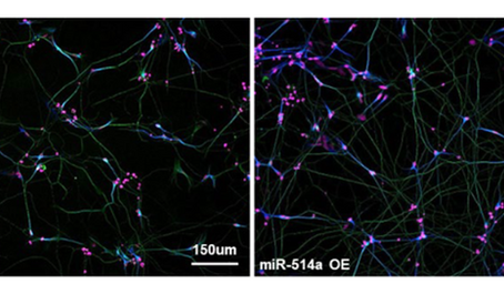 健康を科学で紐解く シリーズ157 「動物種特異的非翻訳 RNA・miR-514a の神経発達促進作用の発見」