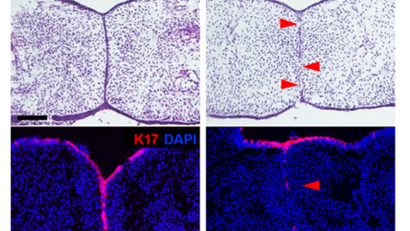 健康を科学で紐解く シリーズ251 「葉酸が口蓋裂の発症を予防する仕組みを解明」