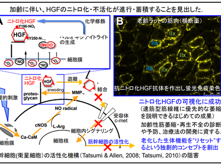 健康を科学で紐解く シリーズ268 「加齢に伴う筋肉の萎縮と柔軟性低下の根本的な仕組みを発見」